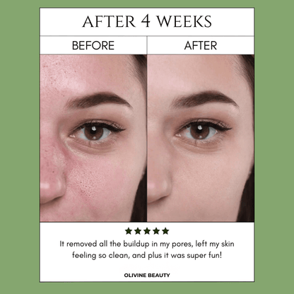 Holy Basil Bubble Mask