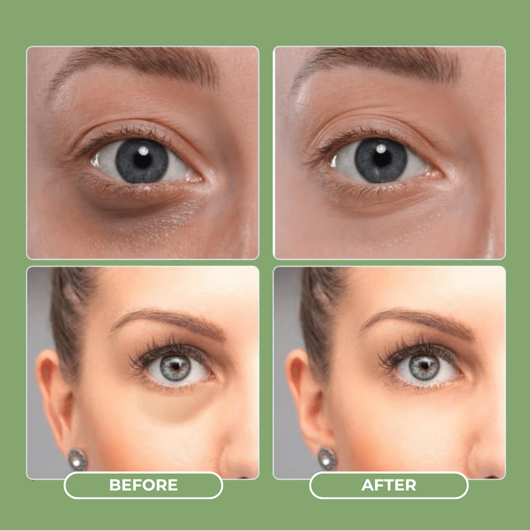 Avocado Eye Mask