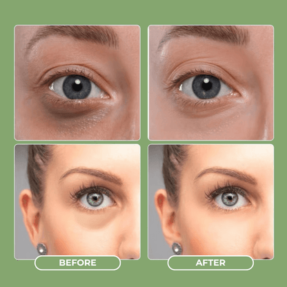 Avocado Eye Mask
