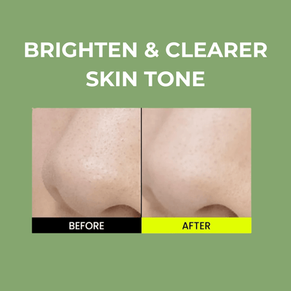 Beplain Skin Detox Trio for Filter Skin